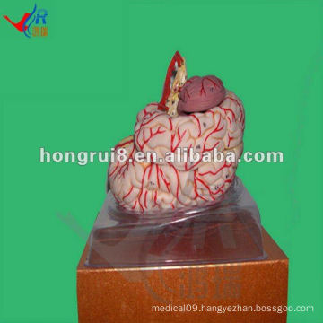 ISO Advanced Cerebral Artery model, Human Brain Anatomy Model